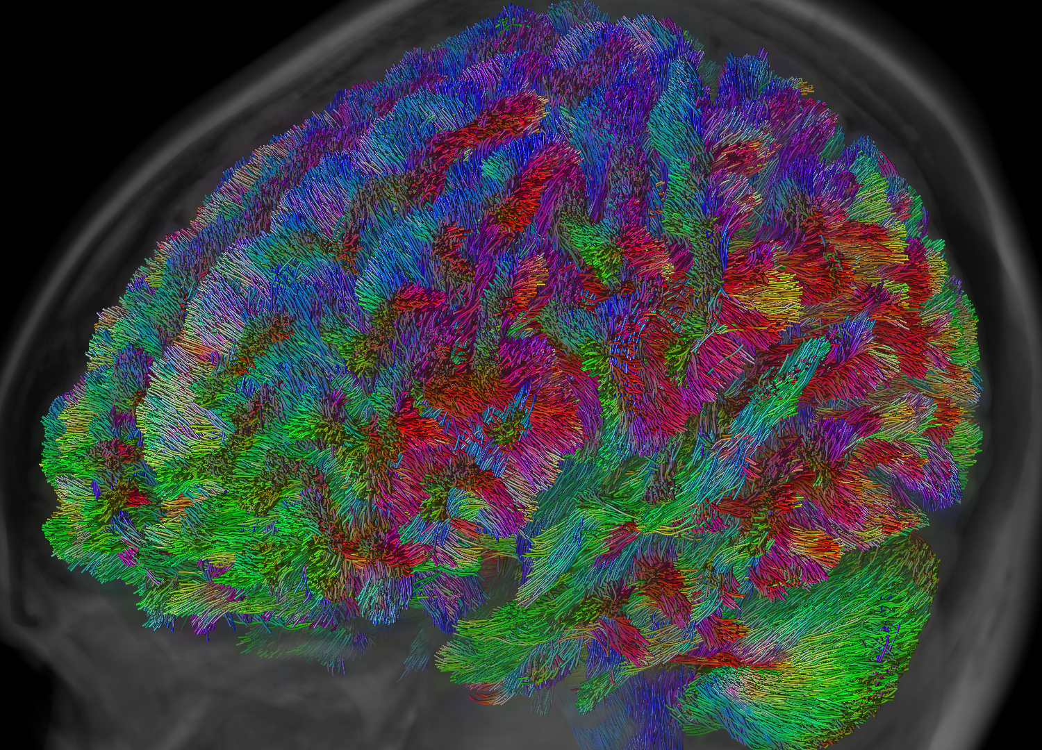 Image courtesy of Dr. Thijs Dhollander
